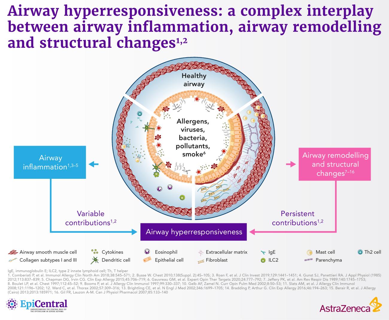 Airway Hyperresponsiveness In Severe Asthma | AZ EpiCentral Global